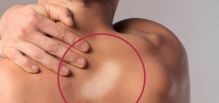 Dia Internacional do Hanseniano